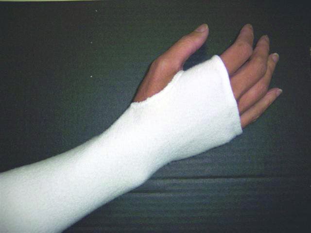 Splint Sock, Coolmax with Thumb Hole | Comfort & Conformity
