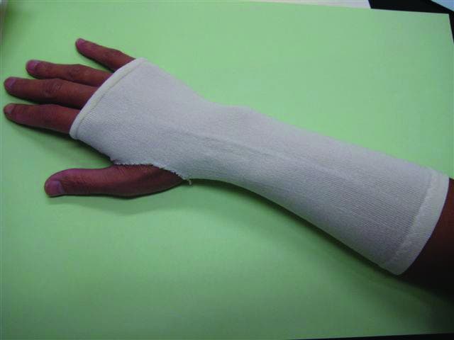 Splint Sock with Thumb Hole | Comfort & Conformity