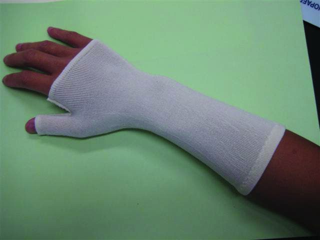 Splint Sock with Thumb Spica | Protection & Comfort