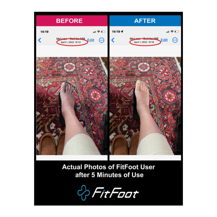 FitFoot-Lite