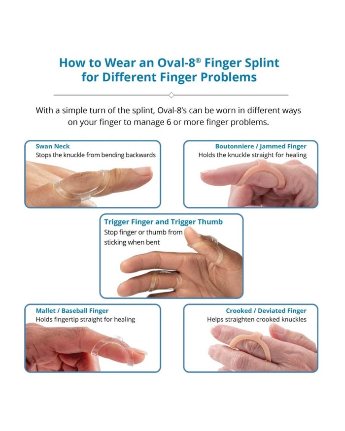 Finger Splints - Hand Therapy & Splinting