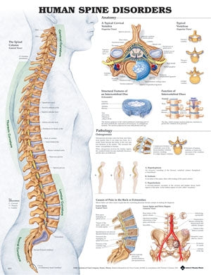 Poster Human Spine Disorders