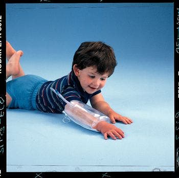Urias Pressure Splints | Edema Compression Splints
